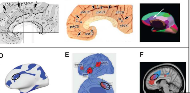 An Inquiry Into Discomfort